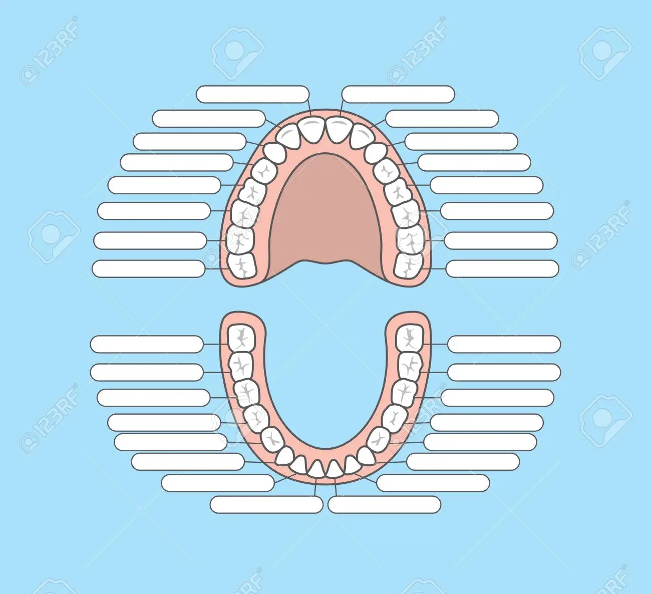 Why do permanent retainers break?