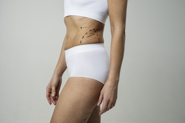 476061_liposuctionindubai